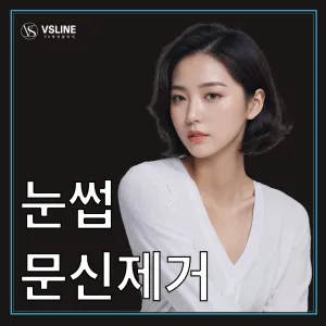 일산 눈썹문신제거