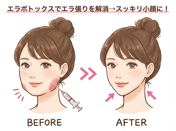 보톡스 주사 빈도・지속 기간・오래 유지하는 요령, 전부 알려드립니다