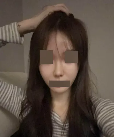 두번째 코수술 원트에서 성공했어요 ^^