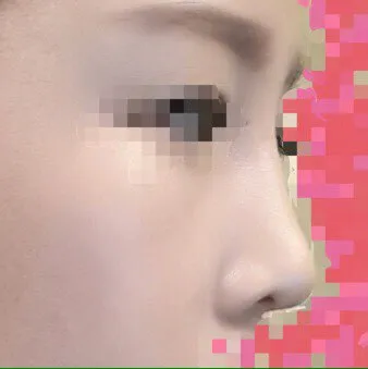 오랜만이예요