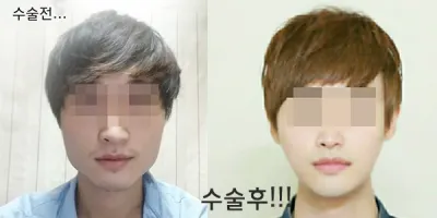 안녕하세요. 오랜만에 경과 보러 병원다녀왔다가
