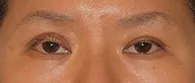 안녕하세요 원장님. 어제 실밥뽑으러 다녀온 화여사입니다~