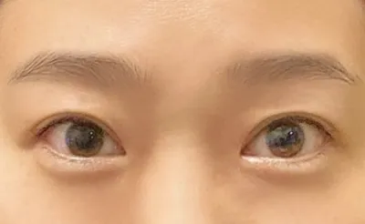 자연유착
