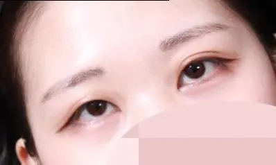 자연스럽고 또렷한 라인이 생겨서 너무 만족합니다!