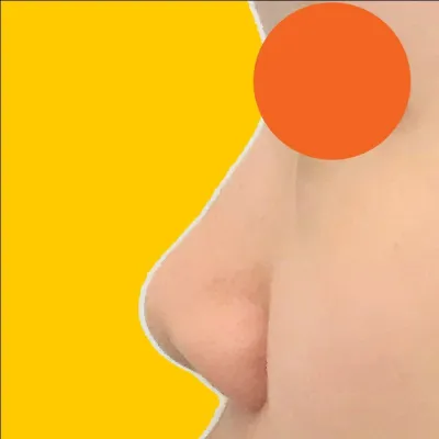 제가 병원 하나는 기가막히게 잘고른거 같네영ㅋㅋ