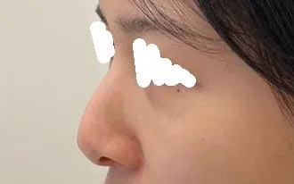 왜진작 안했는지ㅠㅠ 더빨리이뻐질것 ㅜㅜ