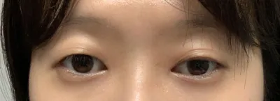 그래도 결과가 너무 좋아서 추천드립니다!!