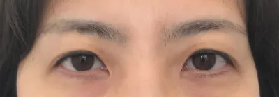 사람들이 이미지가 달라졌다며 병원이랑 원장님 누구냐고 자꾸 물어보네요 ㅎㅎ