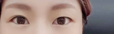 3개월차 후기남깁니다