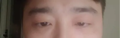 두서없네요.눈매교정 베리굿 추천합니다!!!!