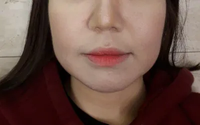 빠른상담, 시원한 설정, 만족스러운 시술 결과를 가져다주신 김준현 원장님 정말 감사합니다~!