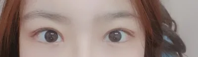 자연유착 4달차입니다!