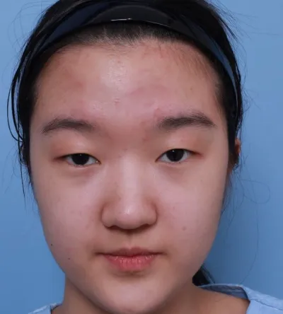 눈 7일차에요