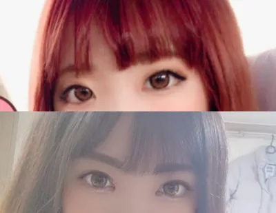 눈 수술후기