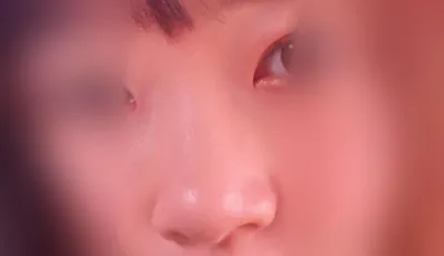 기타 수술후기