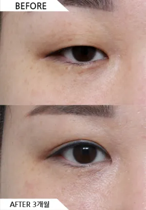 Before