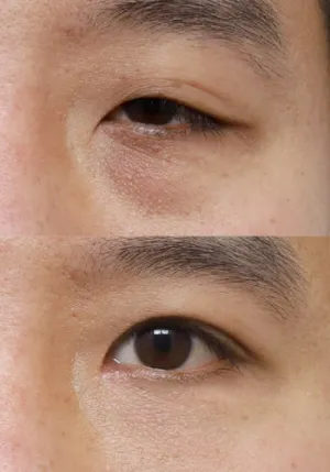 After