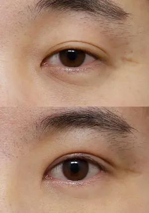 After