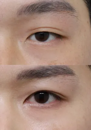 After