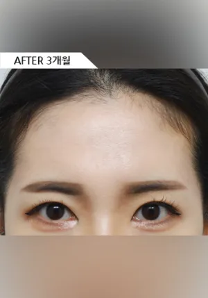 After