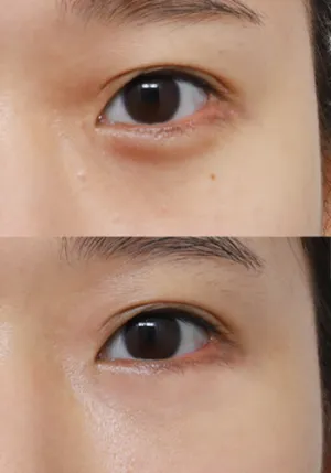 After