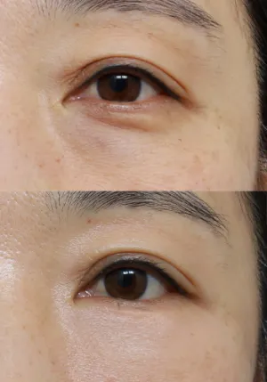 After