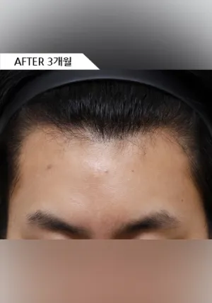 After
