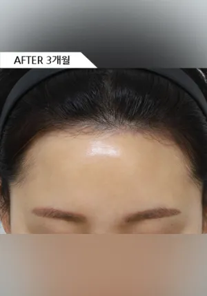 After