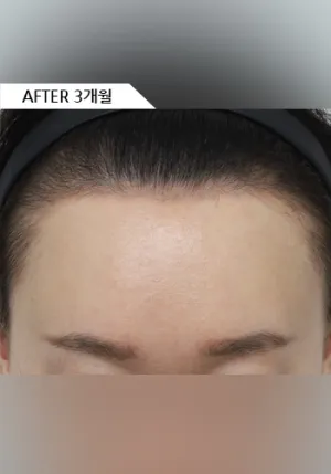 After