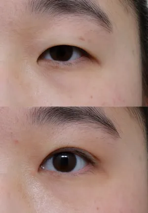 After
