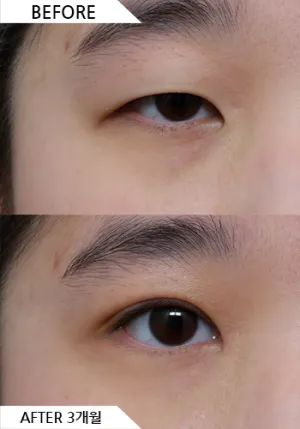 Before