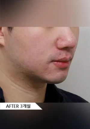 After