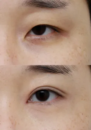 After