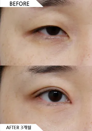 Before