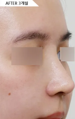 After