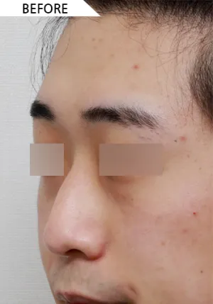 Before