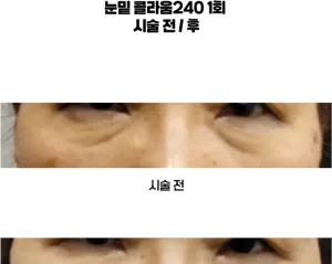 Before