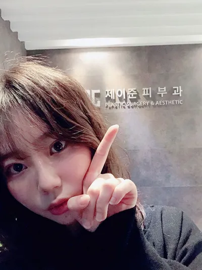 윤곽주사 맞았어용