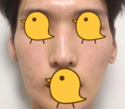 광대축소