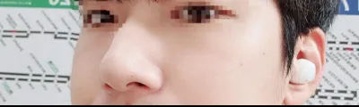 수술하고 5개월만에 후기올려요!