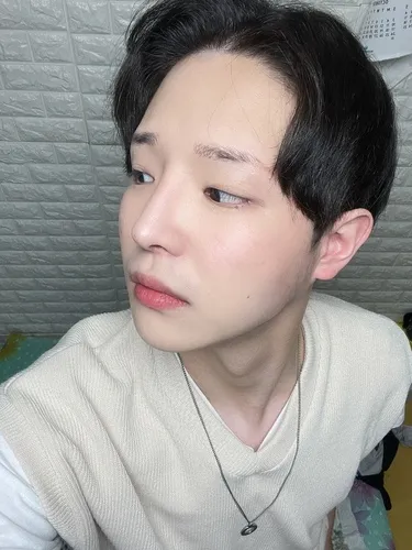 [남자] 혁쓰 - 절개눈매교정, 앞트임, 코