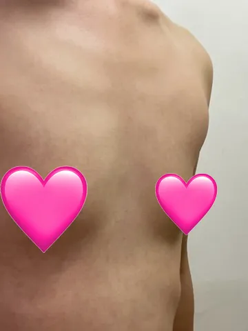 [가슴] 네모빔 - 가슴