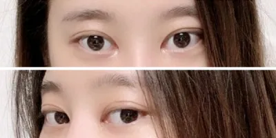[눈] 두치쓰 - 눈