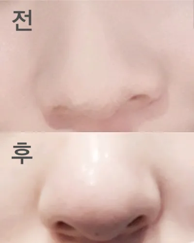 [쁘띠] 쁘루 - 코조각주사