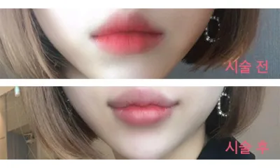 [쁘띠] 예뻐지잙 - 입술필러
