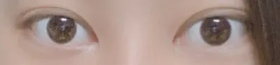 [눈] 뿌꾸뿌꾸빰빰1 - 쌍꺼풀, 뒤트임, 밑트임