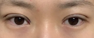 [눈] 뀨루륙 - 눈