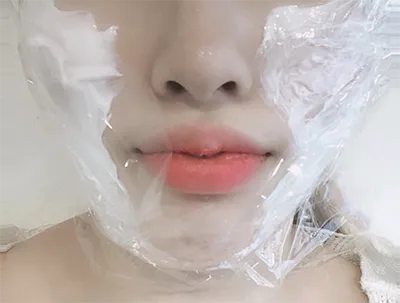 [피부] ㅁㅋㅌㅇㅎㅅ - 슈링크, 윤곽톡스