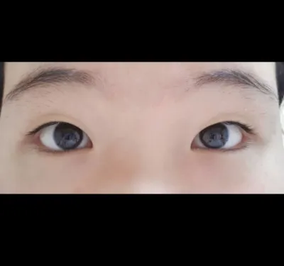 [눈] 써유윤 - 매몰, 앞트임