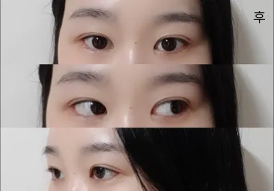 [눈] 기솝 - 눈